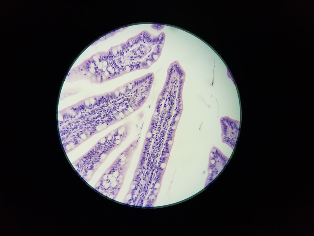 Simple Columnar Epithelium Slides - Simple Columnar Epithelium 01 100X